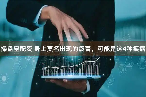 操盘宝配资 身上莫名出现的瘀青，可能是这4种疾病